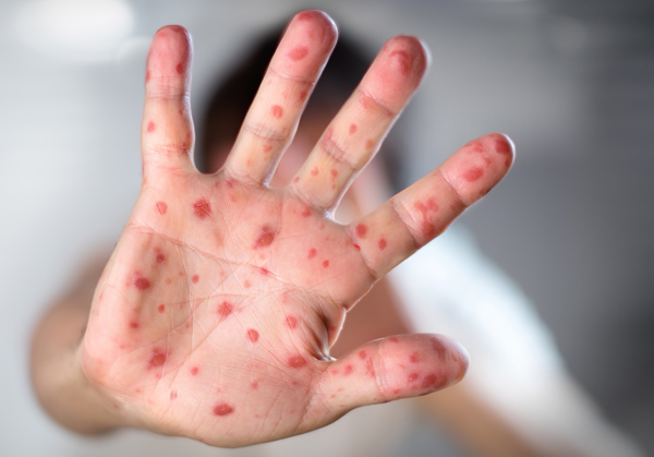 Рубрика «Советы врача»